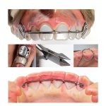 Orthodontics Kindle Book WD Publishing 3rd Edition-0