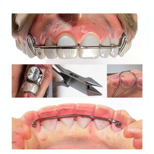 Orthodontics Kindle Book WD Publishing 3rd Edition-0