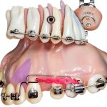 Orthodontics Quintessence Publishing 1263 Page 1st Edition Book-0