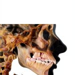Orthodontics Print Replica by Jaypee Brothers 596‑Page Kindle Book-0