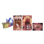 Orthodontics 3rd Edition Guide by Elsevier Kindle eBook 640 Pages-0